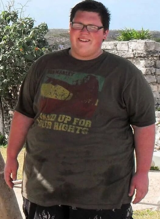 Exces de greutate înainte de utilizarea keto probiotix